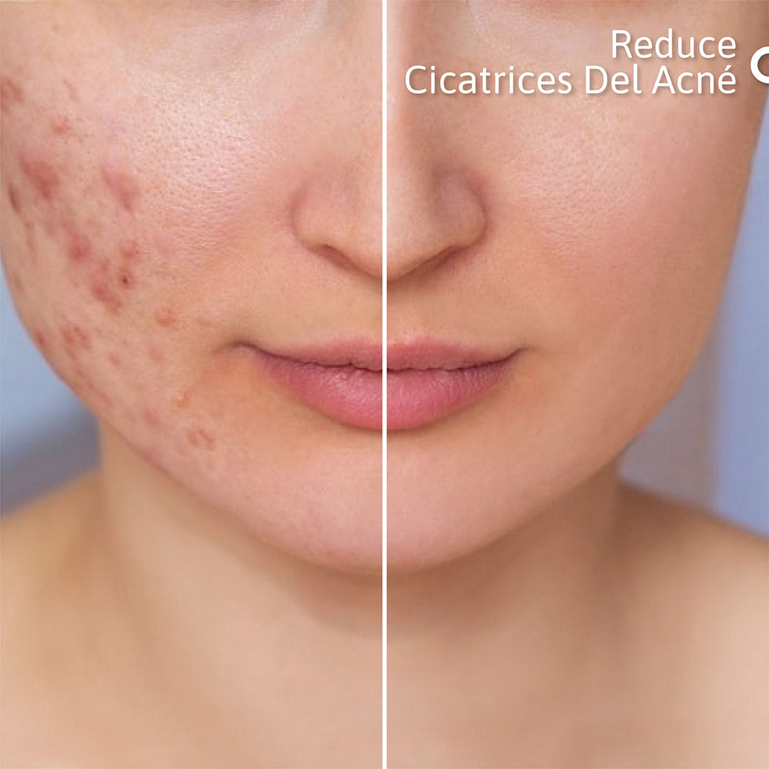Niacik Serum Alpha Arbutin + Niacinamida Reduce Manchas, Elimina Puntos Negros y Control Grasa