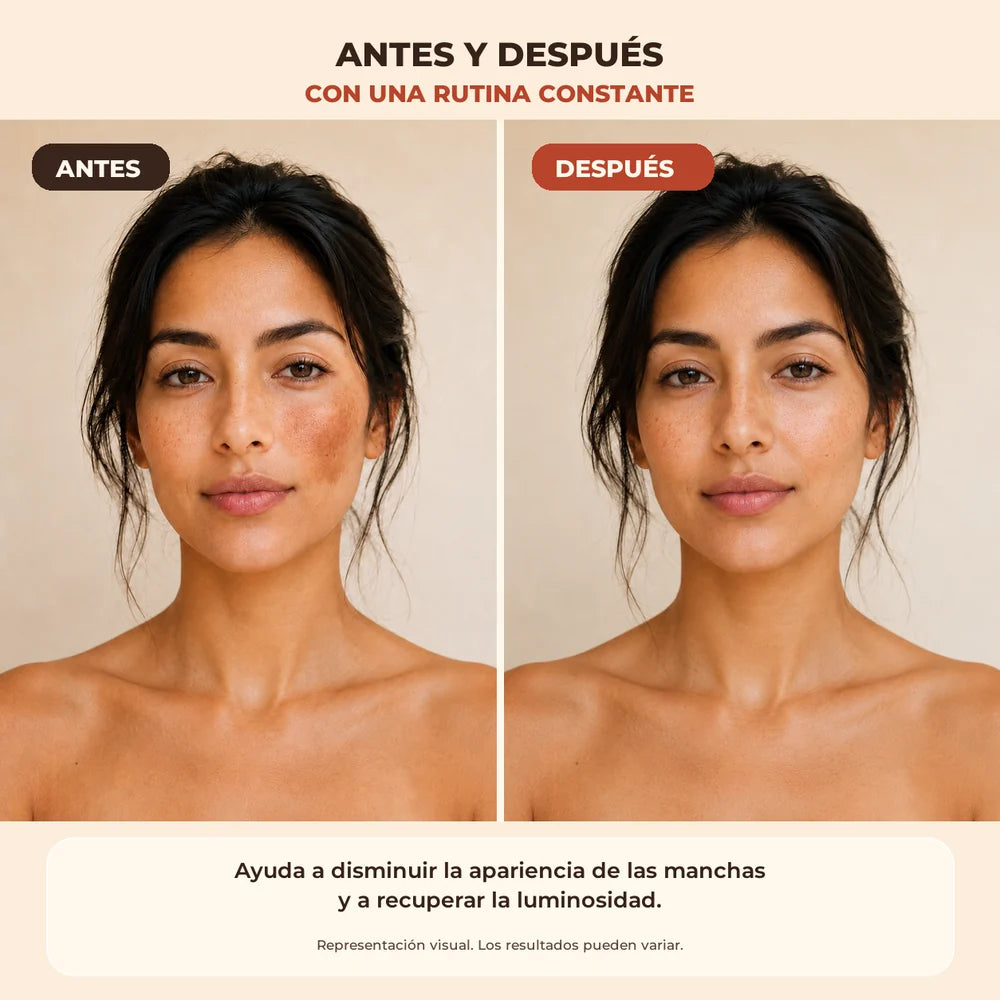 Antes y después ilustrativo de la apariencia de manchas; resultados pueden variar