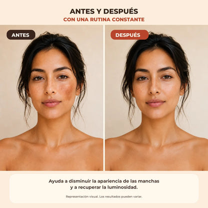 Antes y después ilustrativo de la apariencia de manchas; resultados pueden variar