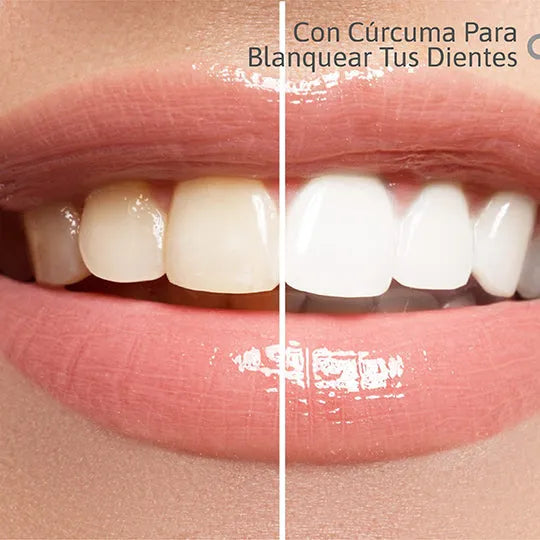 Lumina Smile