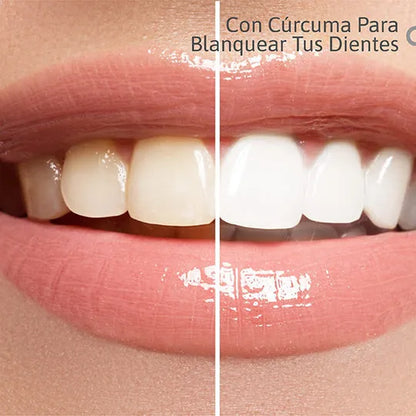 Lumina Smile